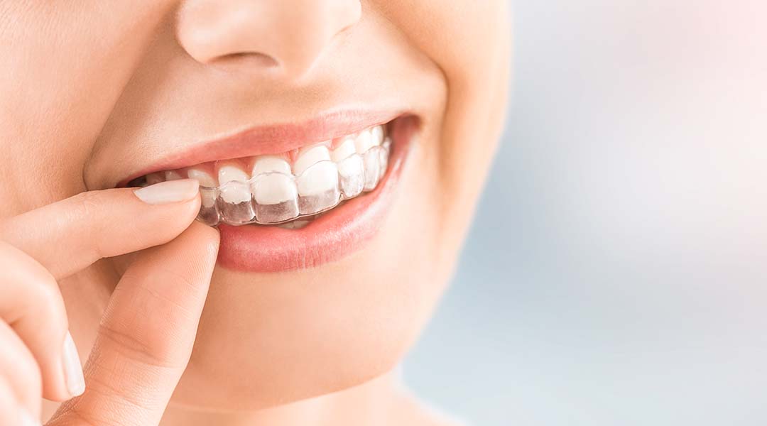 What Is Cosmetic Dentistry? What Does It Include? American Dental